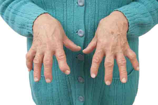 Rheumatoid Arthritis <strong>Be aware of these early symptoms of RA</strong> Rheumatoid Arthritis <strong>Be aware of these early symptoms of RA</strong>