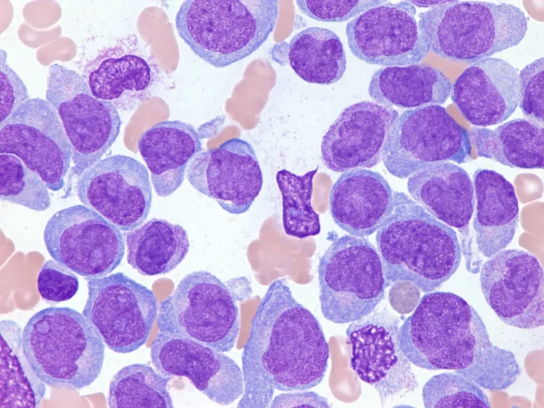 Identifying significant leukaemia treatment resistance obstacle Identifying significant leukaemia treatment resistance obstacle