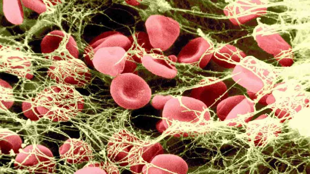 New innovation for blood clots with no risk of increased bleeding New innovation for blood clots with no risk of increased bleeding