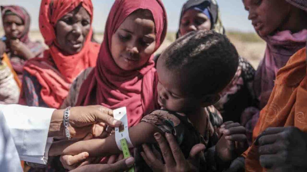 UN head demands “immediate” financial support for the Horn of Africa UN head demands “immediate” financial support for the Horn of Africa