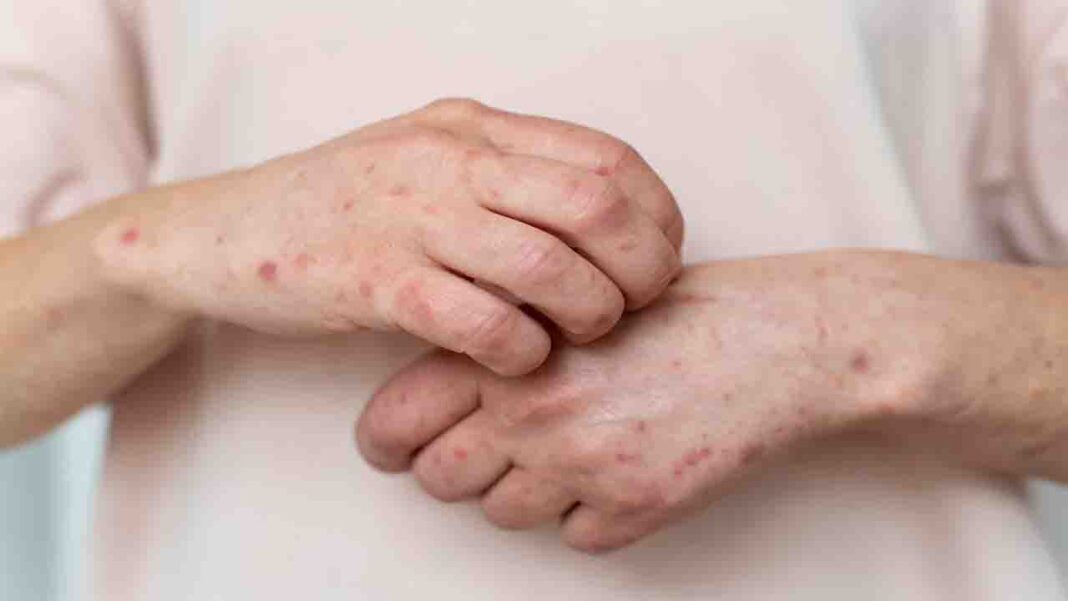 Do you have the same allergy? Do you have the same allergy?