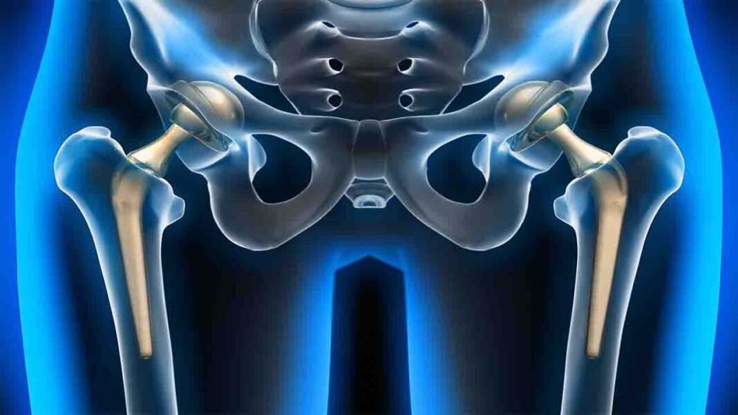 Inappropriate policy for hip replacement…? Inappropriate policy for hip replacement…?