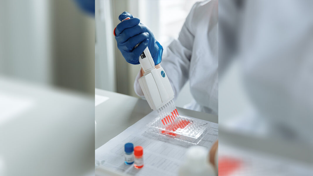 The role of a longevity gene explored in… The role of a longevity gene explored in…