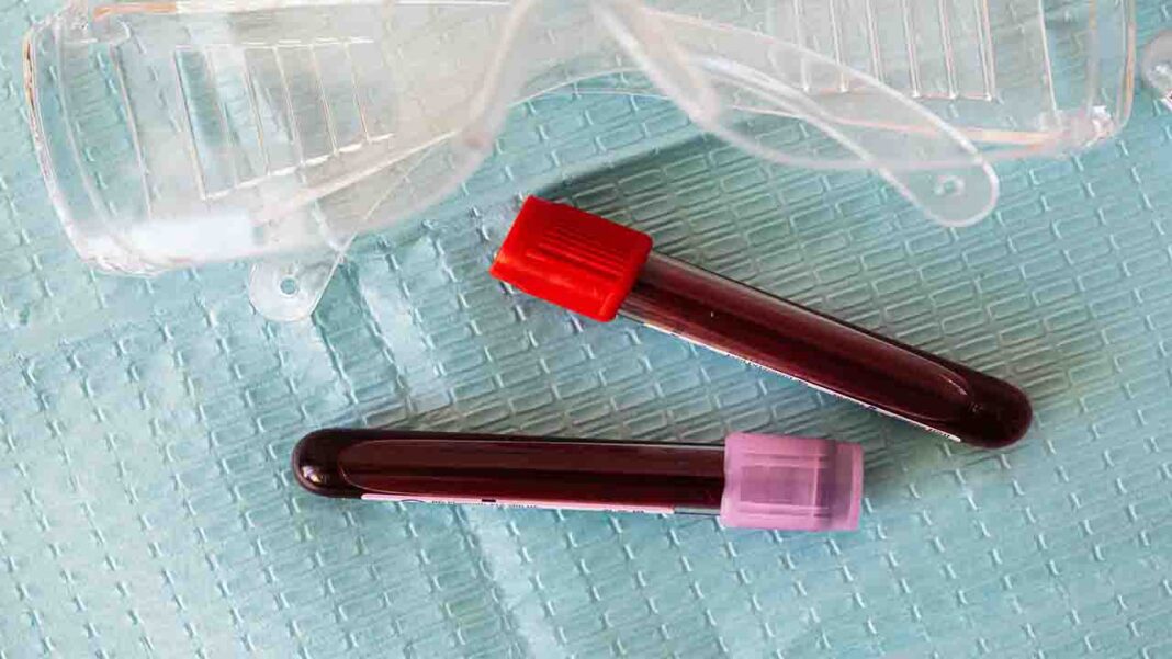 Could a blood test diagnose… disorder? Could a blood test diagnose… disorder?