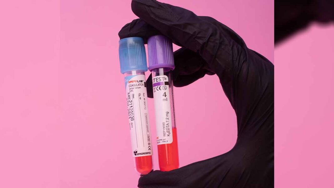 How Biomarkers can enhance diagnosis and treatment How Biomarkers can enhance diagnosis and treatment
