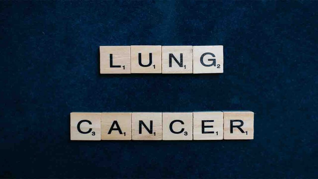 Focusing on lung health on…Month Focusing on lung health on…Month