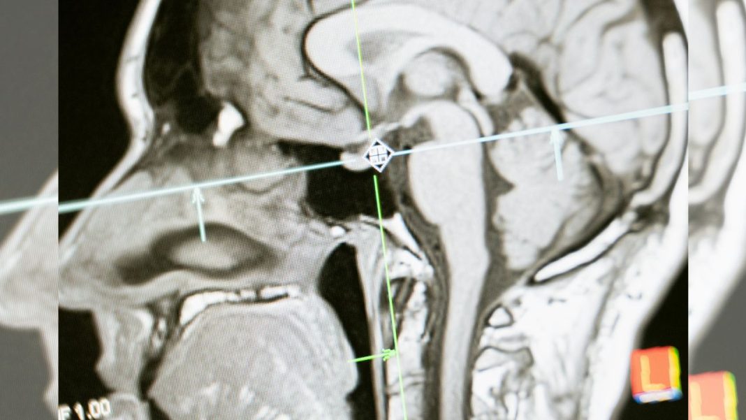 Revolutionary Wireless Charger for Implants Revolutionary Wireless Charger for Implants