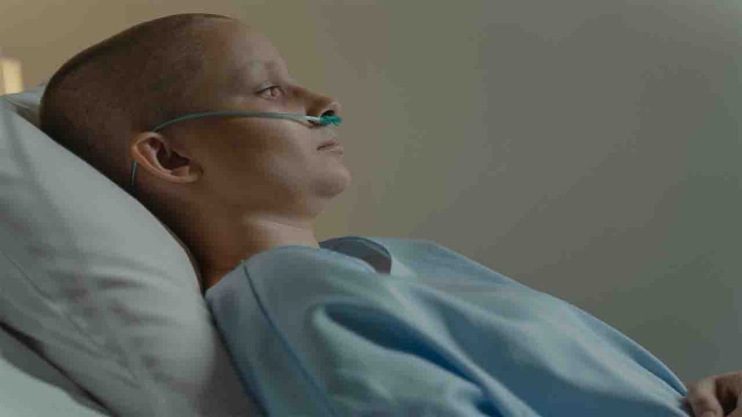 Lung cancer survival rates worsen Lung cancer survival rates worsen