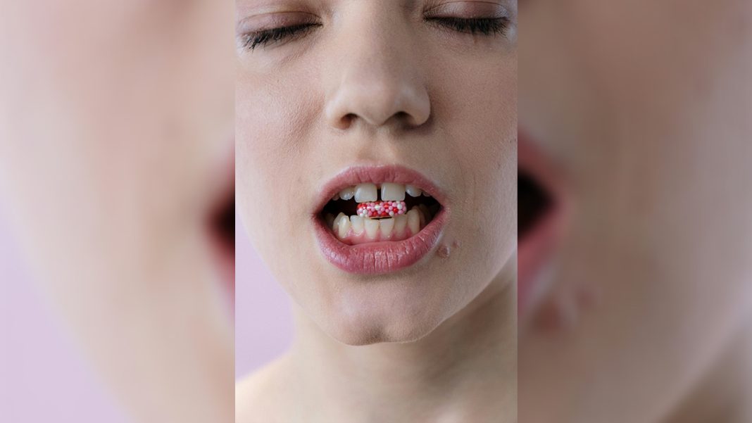 Herpes to escalate Dementia Herpes to escalate Dementia