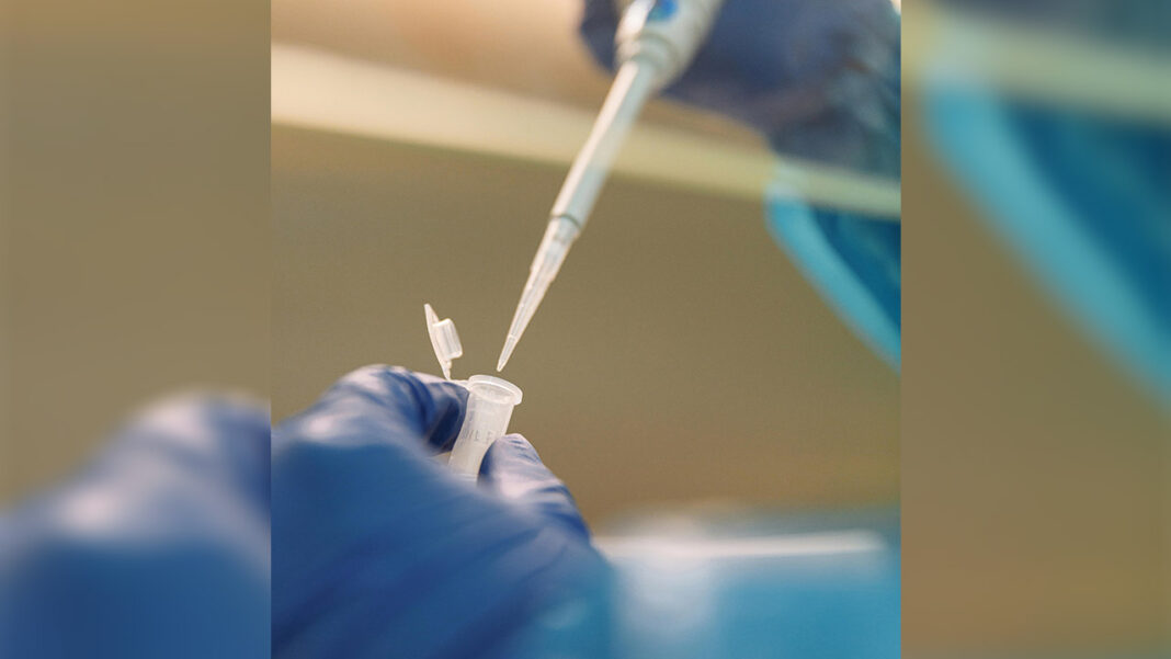 Innovative carbon beads for liver disease? Innovative carbon beads for liver disease?