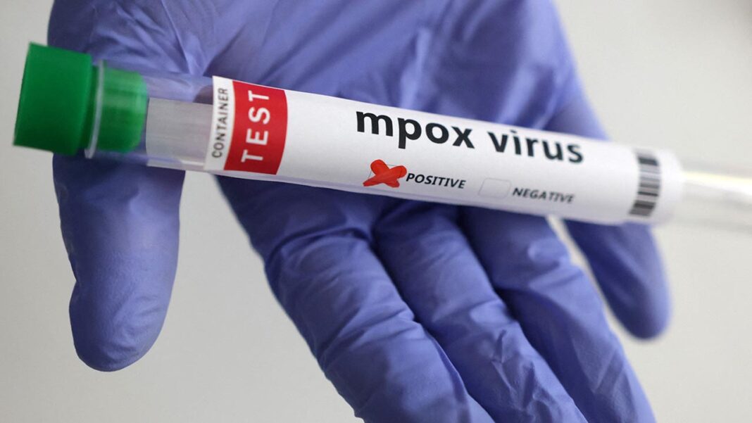 First Asian case of deadly Mpox strain reported First Asian case of deadly Mpox strain reported