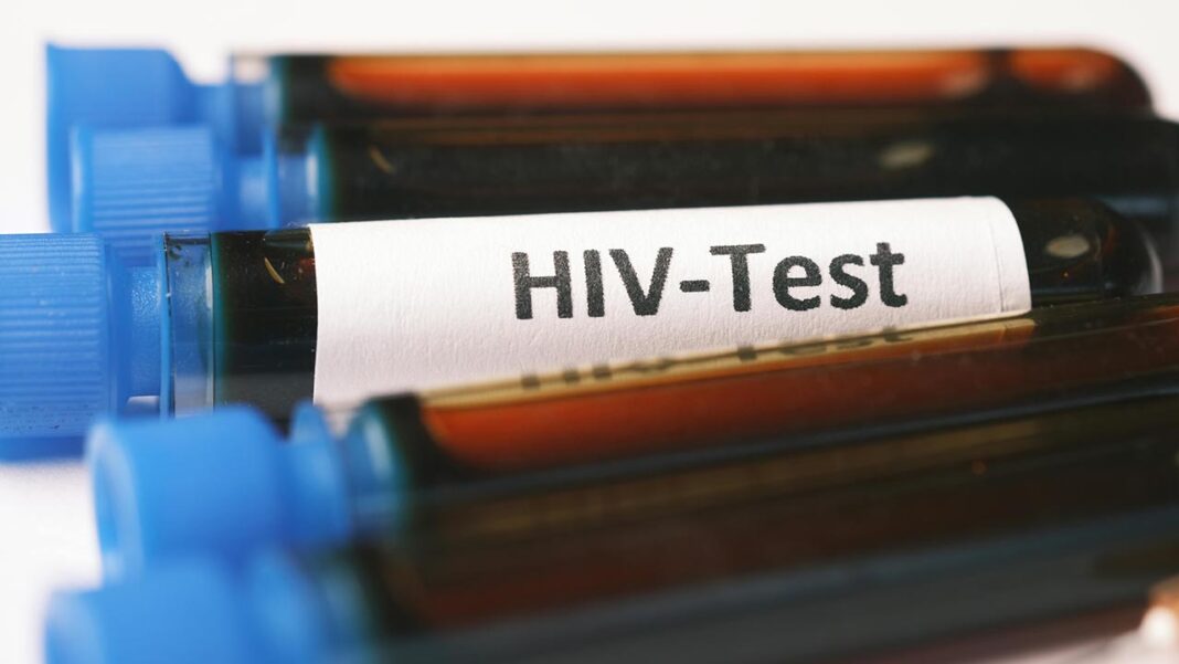 Rwanda’s Success Story in Combating HIV Rwanda's Success Story in Combating HIV