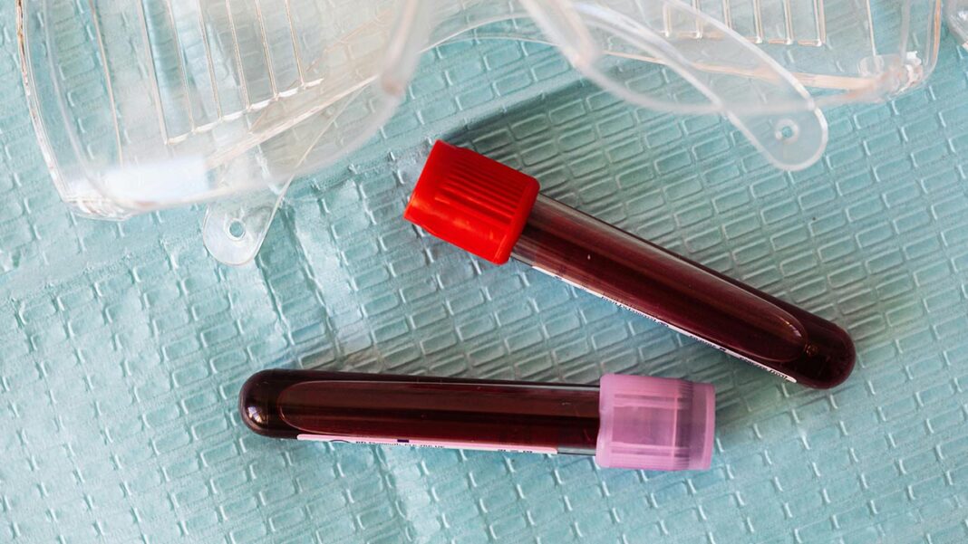Zwitterions: The Secret Weapon Against Blood Clots in Medical Implants?