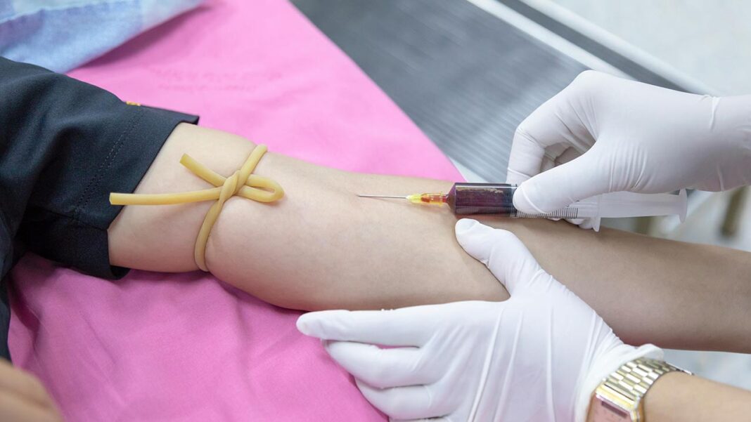 Is Your Body Older Than Your Age? This Blood Test Could Change Healthcare Forever! Is Your Body Older Than Your Age? This Blood Test Could Change Healthcare Forever