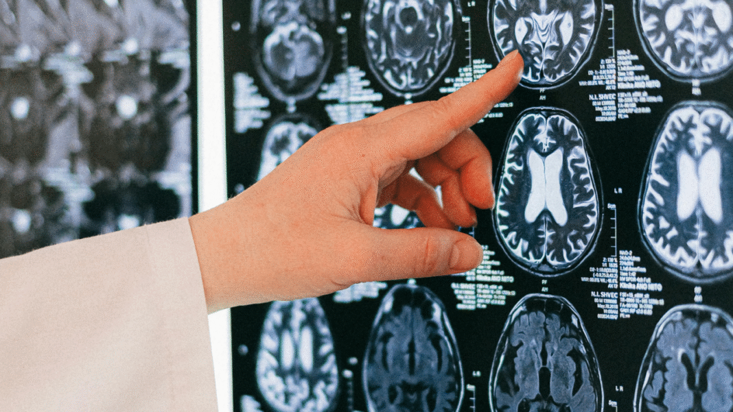 This AI Uses a ‘Feedback Loop’ Trick to Outsmart Traditional Medical Tech — With Less Data!