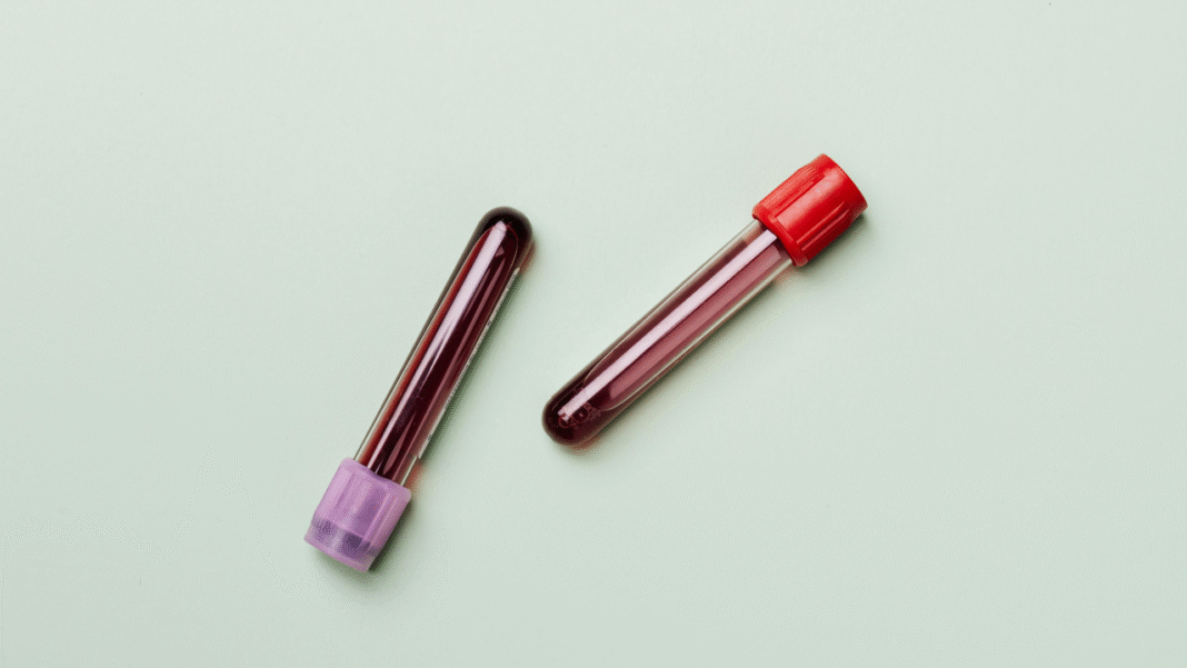 Platelets Aren’t Just for Clotting—They Might Be Secret Cancer Detectors Platelets Aren’t Just for Clotting—They Might Be Secret Cancer Detectors
