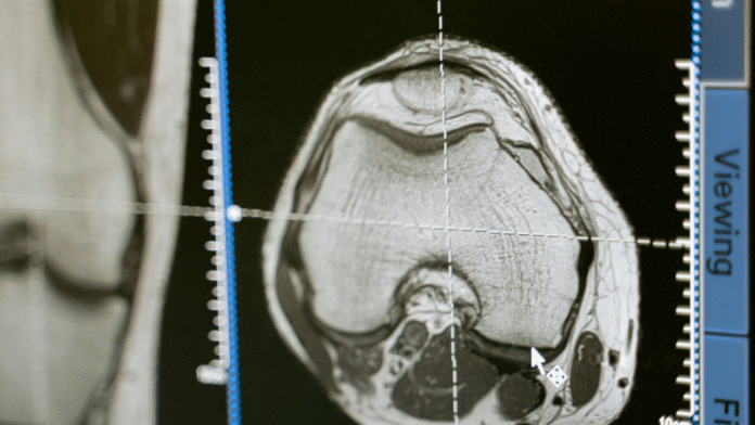The Surprising Brain Layers That Stay Sharp While We Age