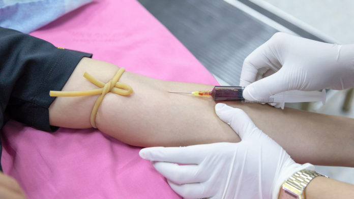 One Blood Test Could Transform How We Detect Alzheimer’s