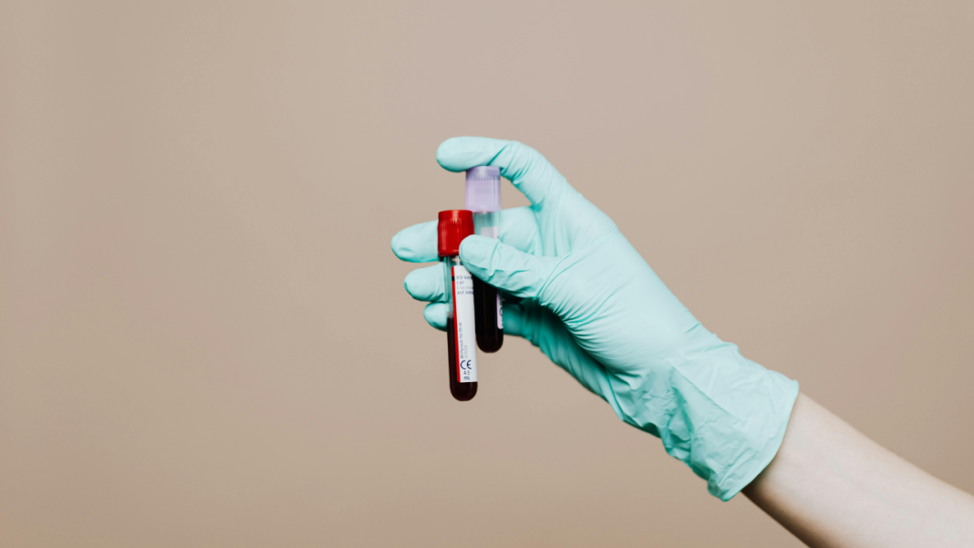 New Study Shows How a Simple Squeeze Makes Cancer Cells More Aggressive New Study Shows How a Simple Squeeze Makes Cancer Cells More Aggressive
