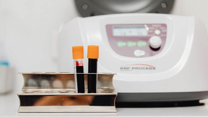 Could a Simple Blood Test Finally Catch Kidney Damage Hours Earlier — and Stop Disease Before It Starts?