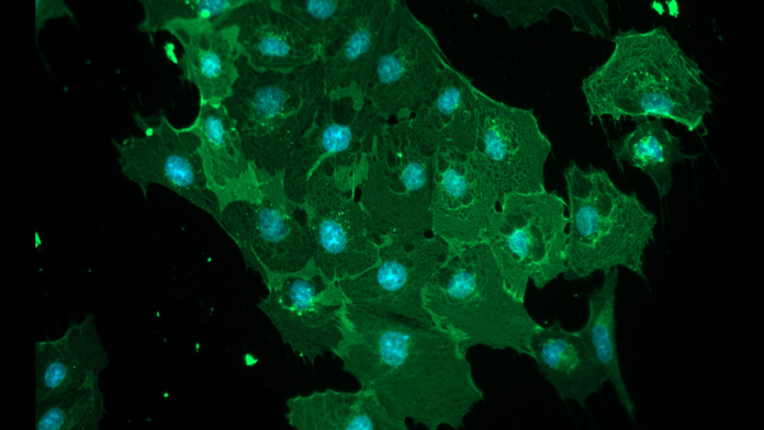 New Study Reveals How Deadly Viruses Breach the Brain’s Defenses