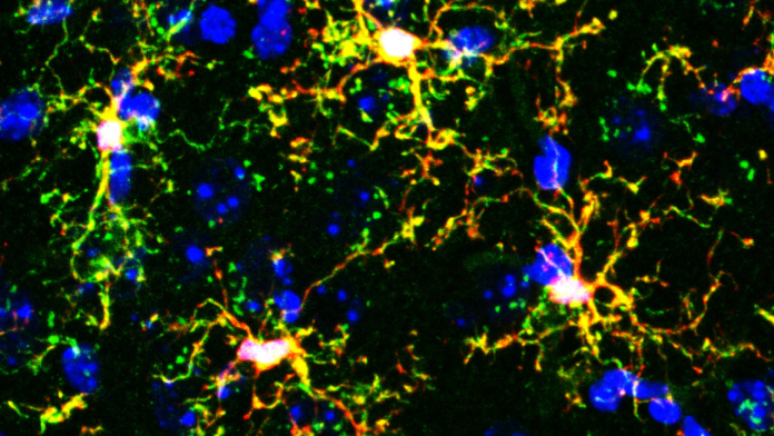 Do Two Immune Cell Types Hold the Key to Why Anxiety Happens?