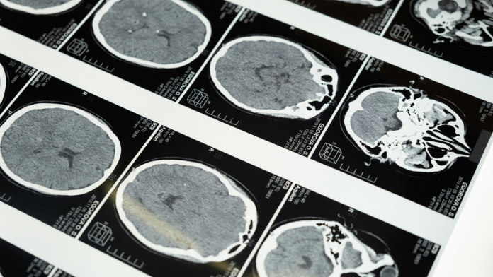 From Brain Mapping to Parkinson’s Cure: How Scientists Are Redefining Cell Therapy Research