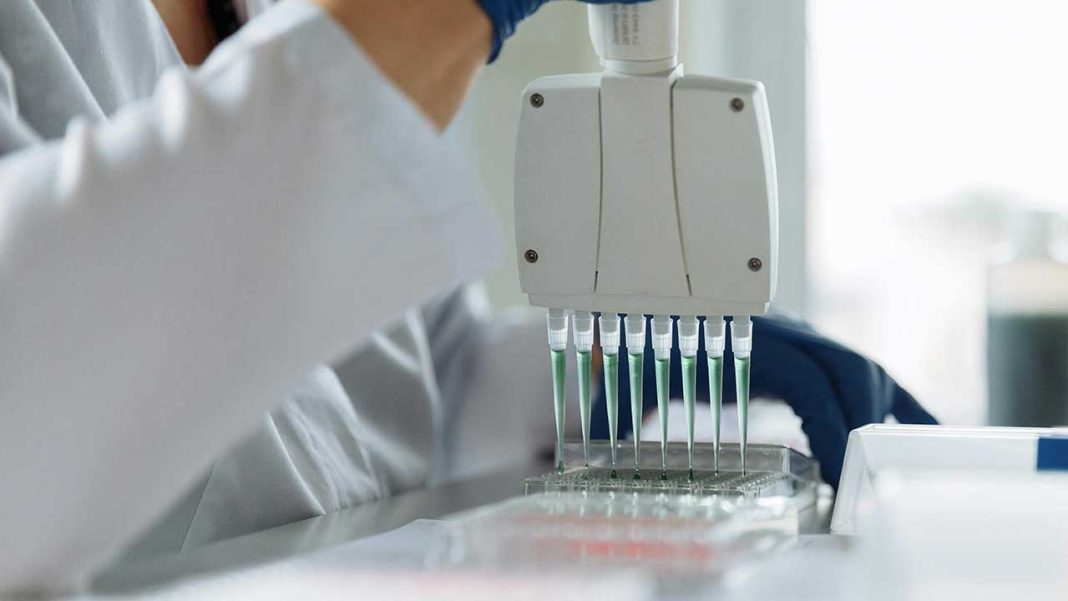 How Does a High-Fat Diet Rewire Liver Cells—and Why Does It Dramatically Raise Cancer Risk? How Does a High-Fat Diet Rewire Liver Cells—and Why Does It Dramatically Raise Cancer Risk?