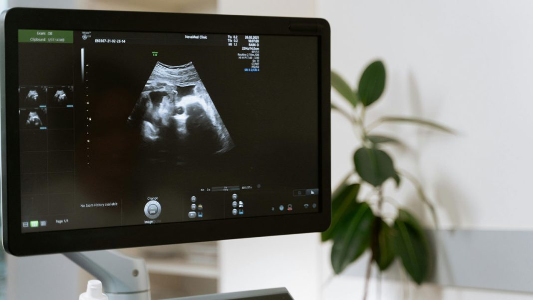 The Sound of Youth? How Ultrasound Could Help Delay Brain Ageing The Sound of Youth? How Ultrasound Could Help Delay Brain Ageing