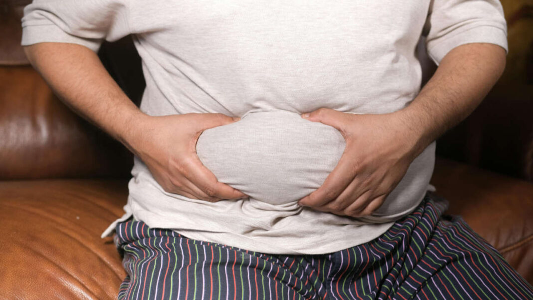 Global Study Links Obesity to 1 in 10 Infection Deaths Worldwide Global Study Links Obesity to 1 in 10 Infection Deaths Worldwide