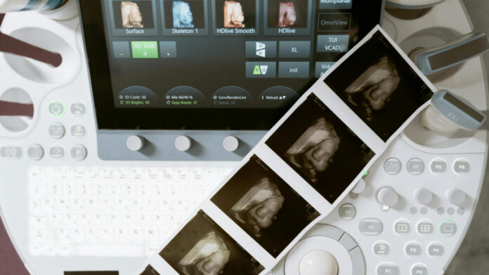 Could AI Become a Standard Companion to Scan Reports? New Analysis Finds Major Gains in Clarity