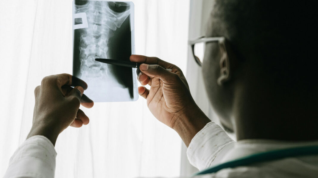 Can a Laser-Printed Gel Heal Broken Bones? Scientists Think It Might