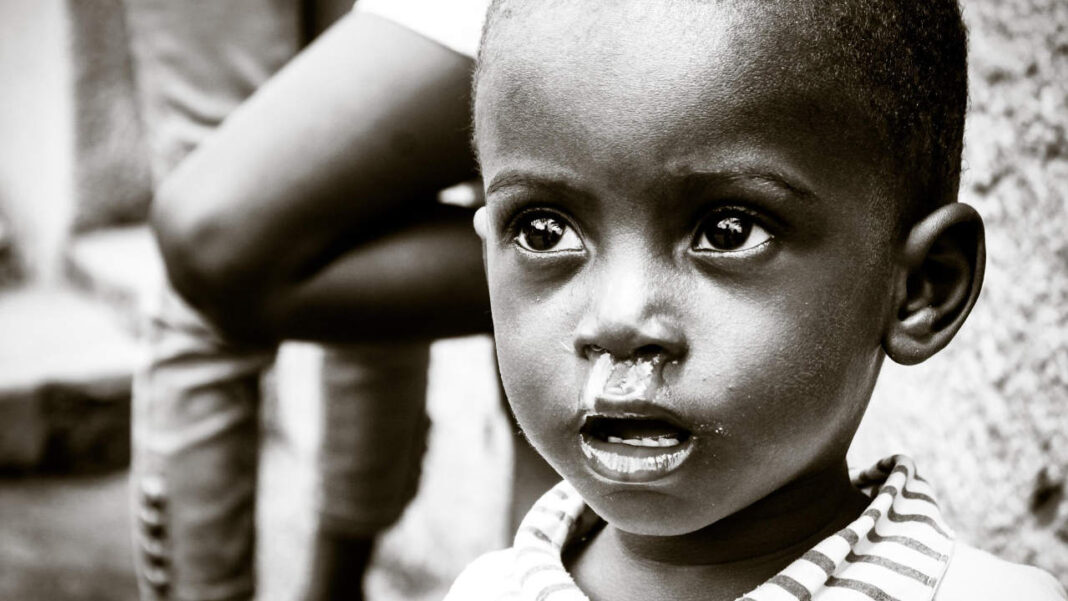 Nigeria’s Hunger Crisis: Children Starve as Clinics Struggle to Cope Nigeria’s Hunger Crisis: Children Starve as Clinics Struggle to Cope