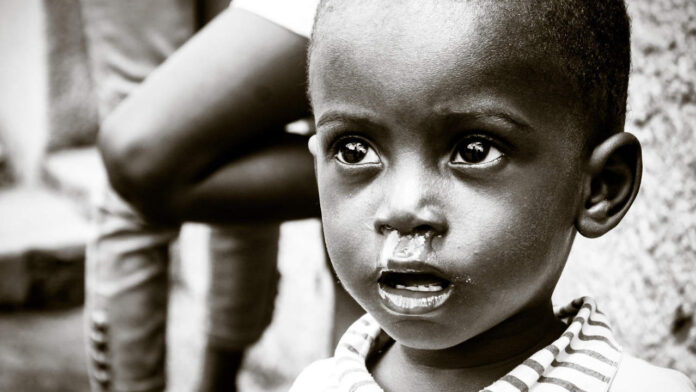 Nigeria’s Hunger Crisis: Children Starve as Clinics Struggle to Cope