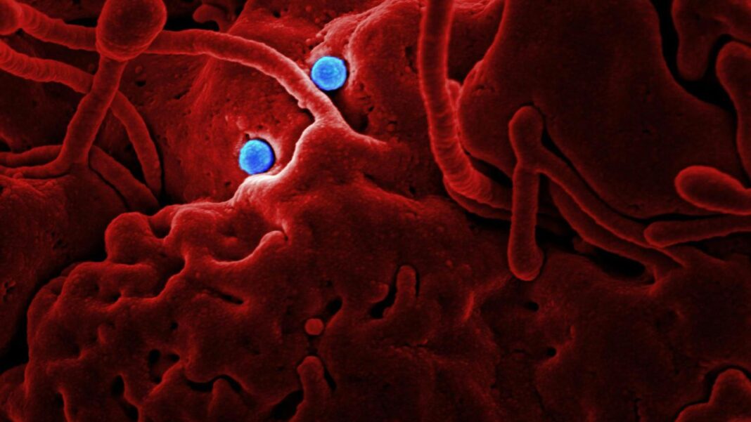 Ebola at the Gates? Why Vanuatu Says There’s No Need to Panic—Yet Ebola at the Gates? Why Vanuatu Says There’s No Need to Panic—Yet