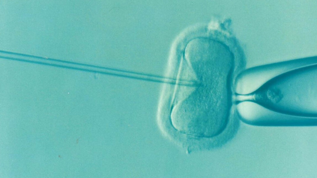 Common IVF Add-On Found Ineffective After Global Review of Patient Data Common IVF Add-On Found Ineffective After Global Review of Patient Data