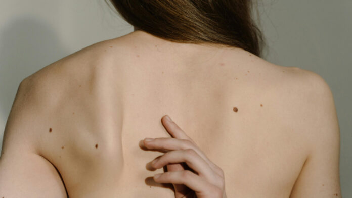 Could a “Smart Tattoo” Detect Skin Cancer Before It Appears?