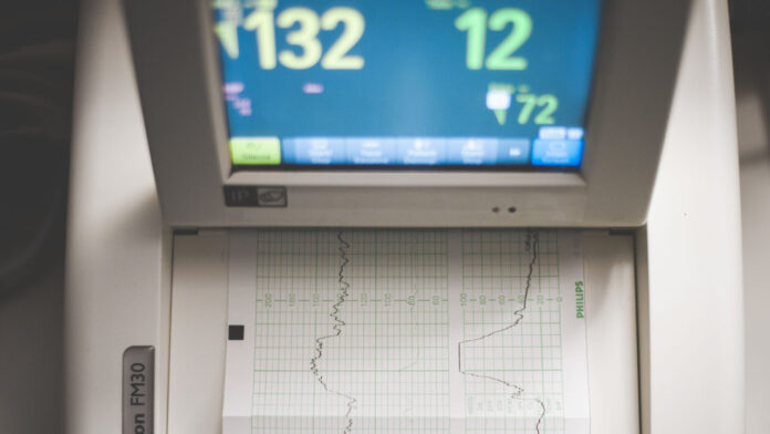 Can AI-Powered Wearable Patches Spot Heart Disease Earlier?