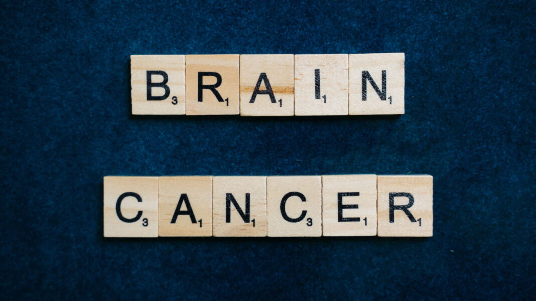 Canadian Cancer Research Breakthrough: McMaster Team Identifies Drug Targets to Prevent Brain Metastases Canadian Cancer Research Breakthrough: McMaster Team Identifies Drug Targets to Prevent Brain Metastases
