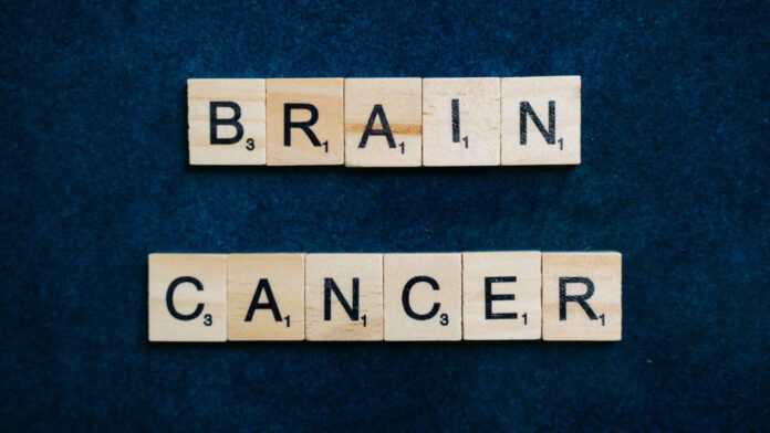 Canadian Cancer Research Breakthrough: McMaster Team Identifies Drug Targets to Prevent Brain Metastases
