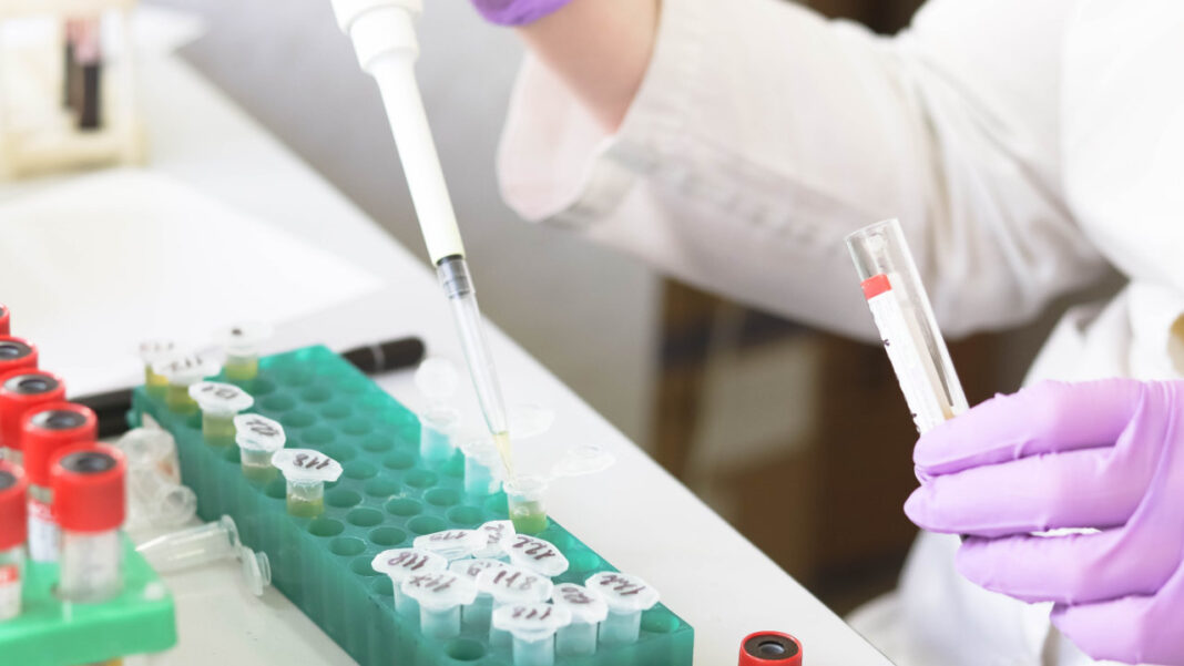 Scientists Discover Discarded Bowel Screening Samples Could Be Used to Study Major Diseases Through Gut Microbiome DNA Testing Scientists Discover Discarded Bowel Screening Samples Could Be Used to Study Major Diseases Through Gut Microbiome DNA Testing