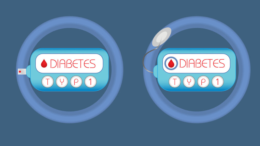 UK NHS Approves Teplizumab for Delaying Type 1 Diabetes Progression UK NHS Approves Teplizumab for Delaying Type 1 Diabetes Progression