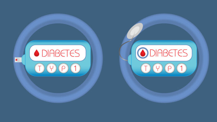 UK NHS Approves Teplizumab for Delaying Type 1 Diabetes Progression
