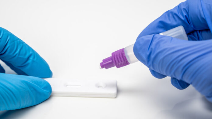 New Motor Neurone Disease Therapy Targets UNC13A Protein as TRCN-1023 Enters International Clinical Trials
