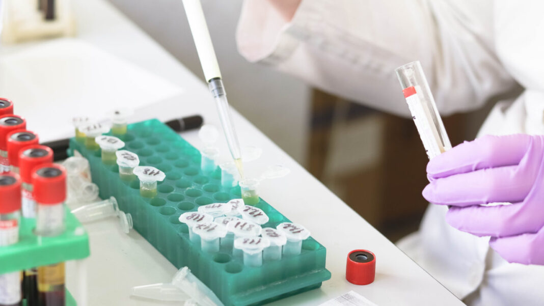 How Cholesterol Keeps Cells Healthy and May Help Explain Parkinson’s and Alzheimer’s How Cholesterol Keeps Cells Healthy and May Help Explain Parkinson’s and Alzheimer’s