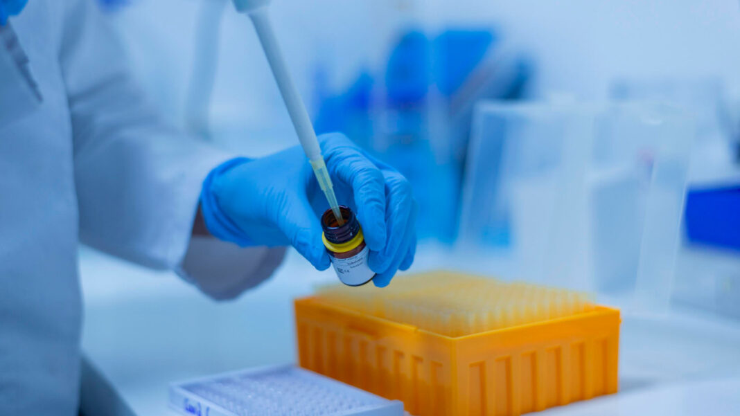 Women with Autoimmune Diseases More Likely to Face Misdiagnosis and Delayed Treatment